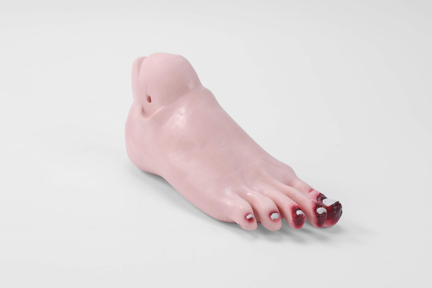 Diabetic Foot Care Model