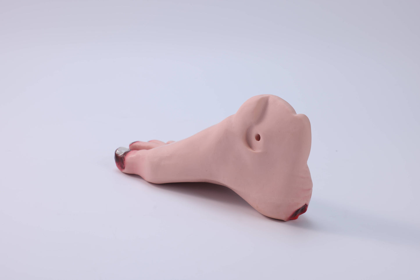 Diabetic Foot Care Model