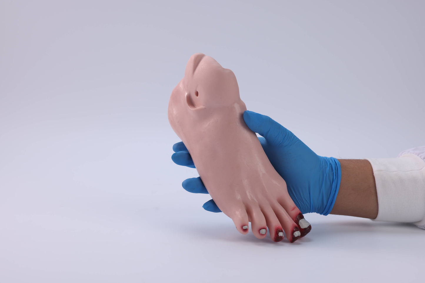 Diabetic Foot Care Model