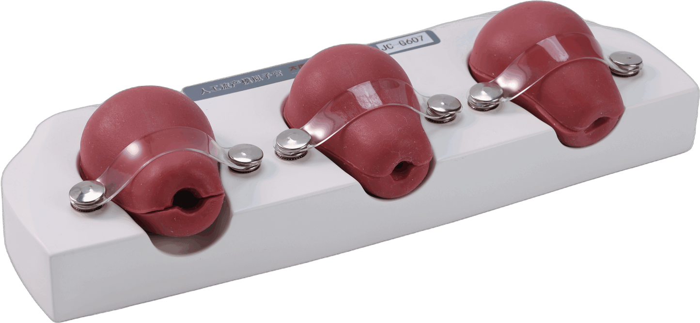 Dilatation and Curettage Model