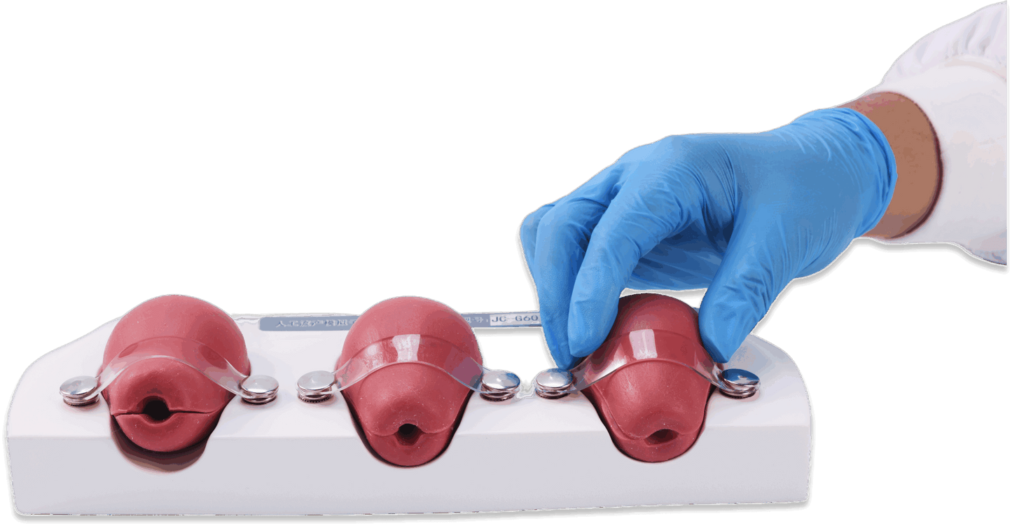 Dilatation and Curettage Model