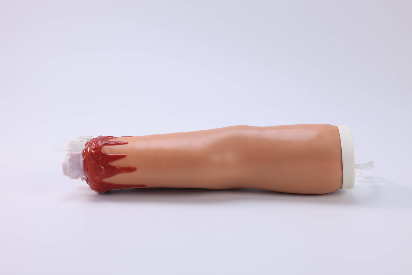 Amputation and Trauma Bleeding Arm