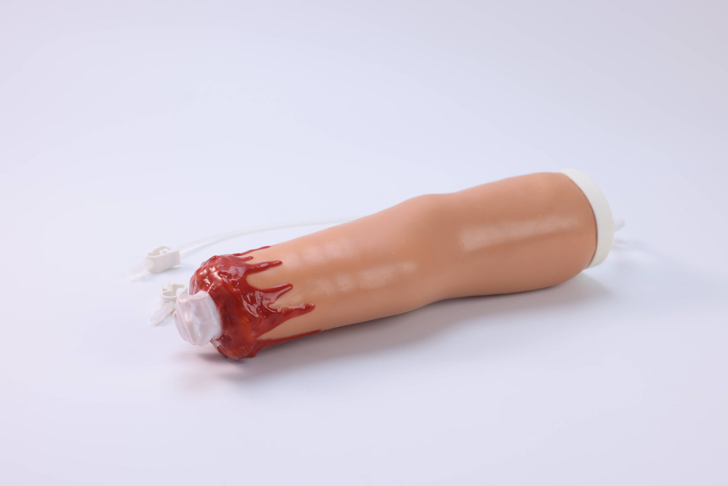 Amputation and Trauma Bleeding Arm