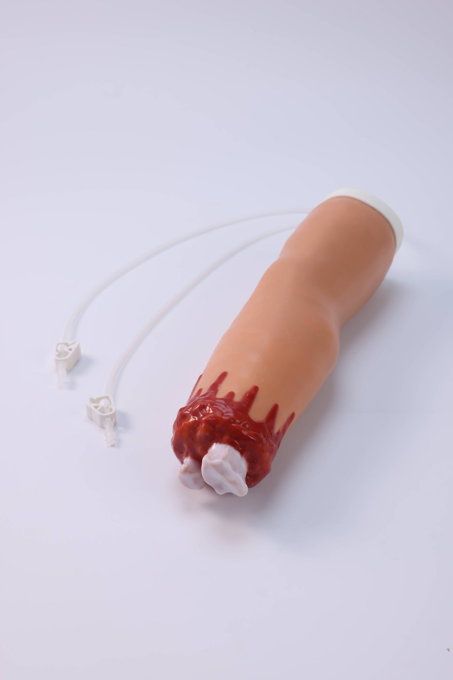 Amputation and Trauma Bleeding Arm