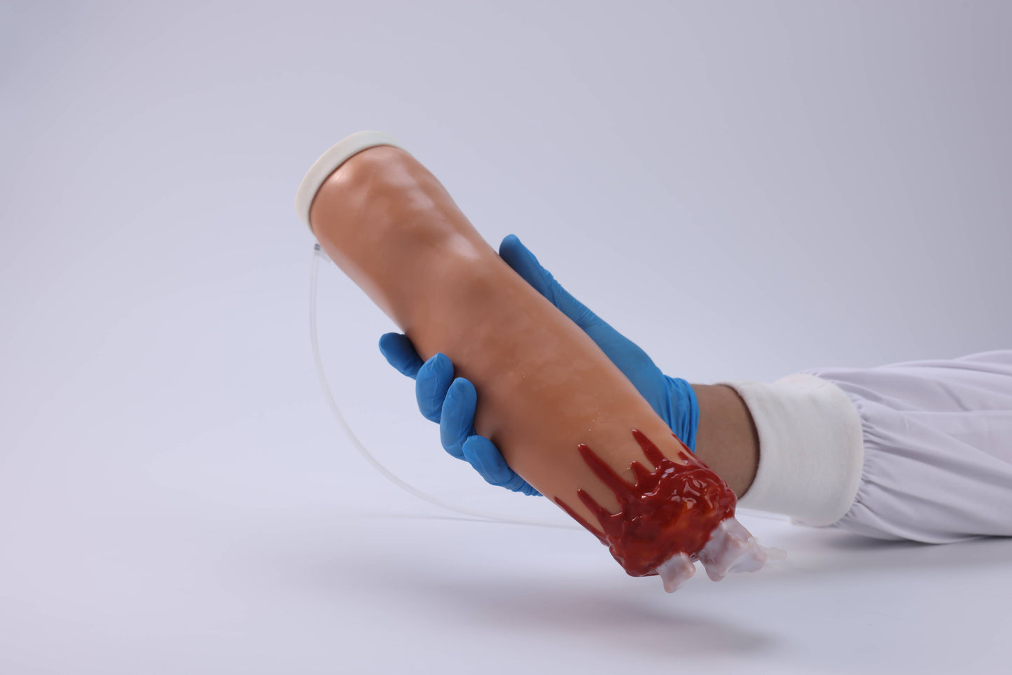 Amputation and Trauma Bleeding Arm