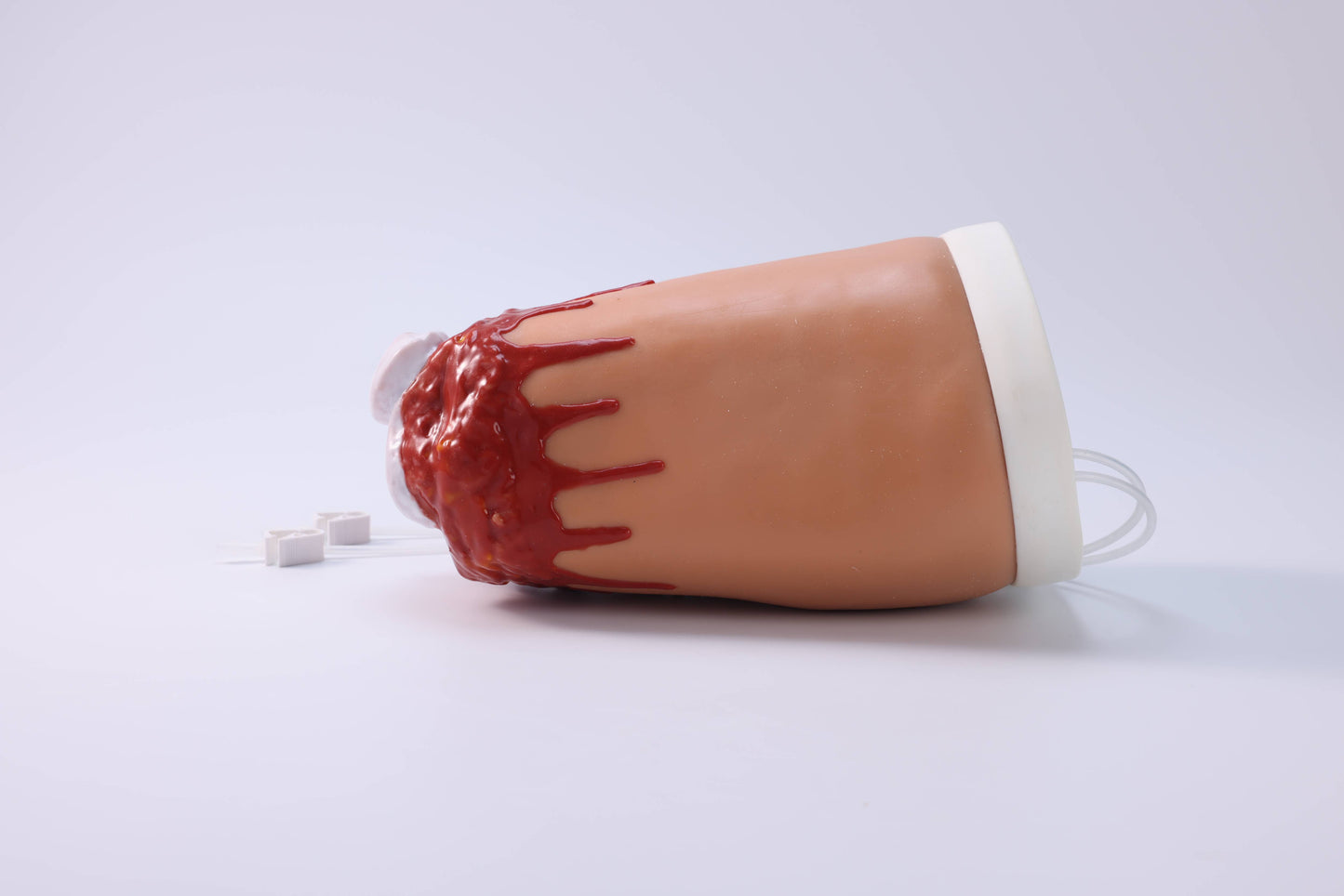 Amputation and Trauma Bleeding Leg