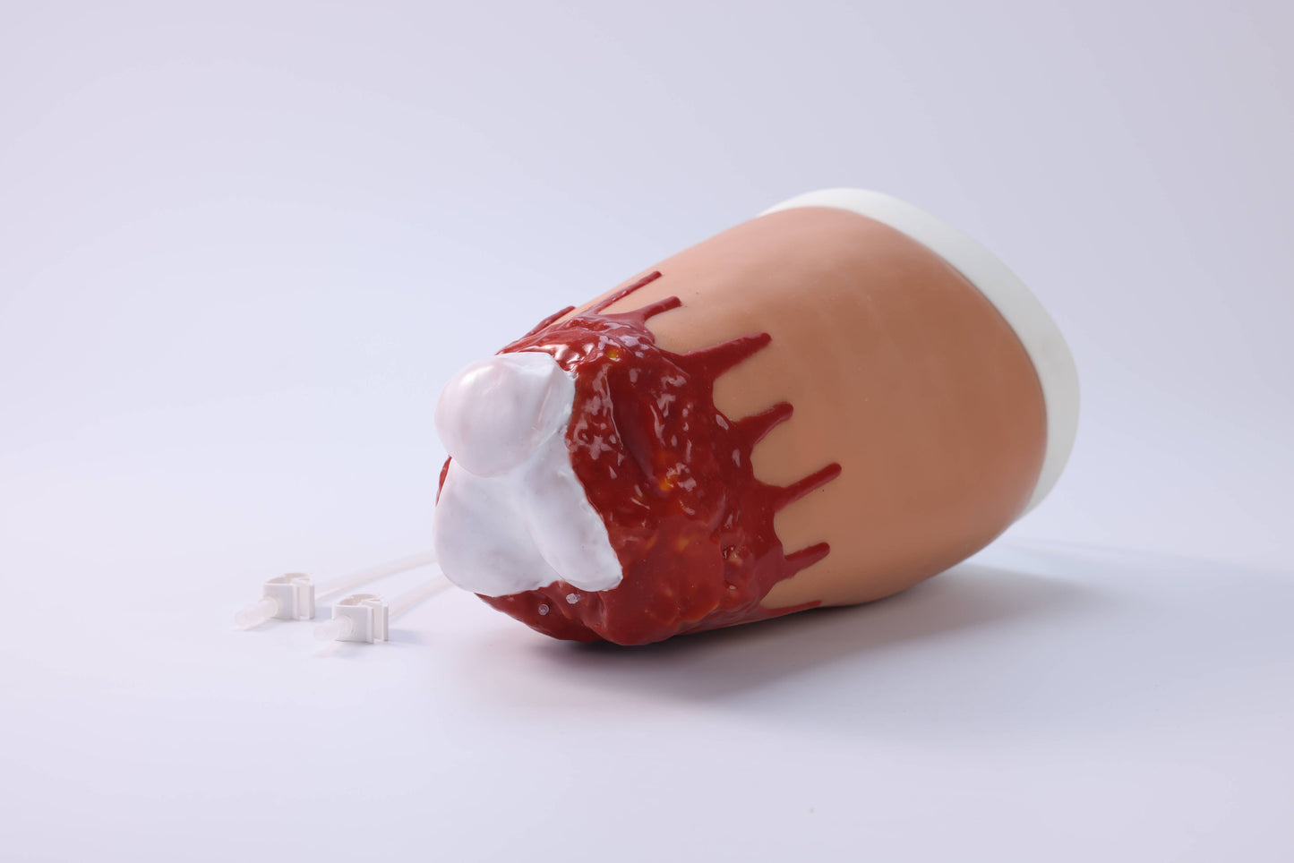 Amputation and Trauma Bleeding Leg