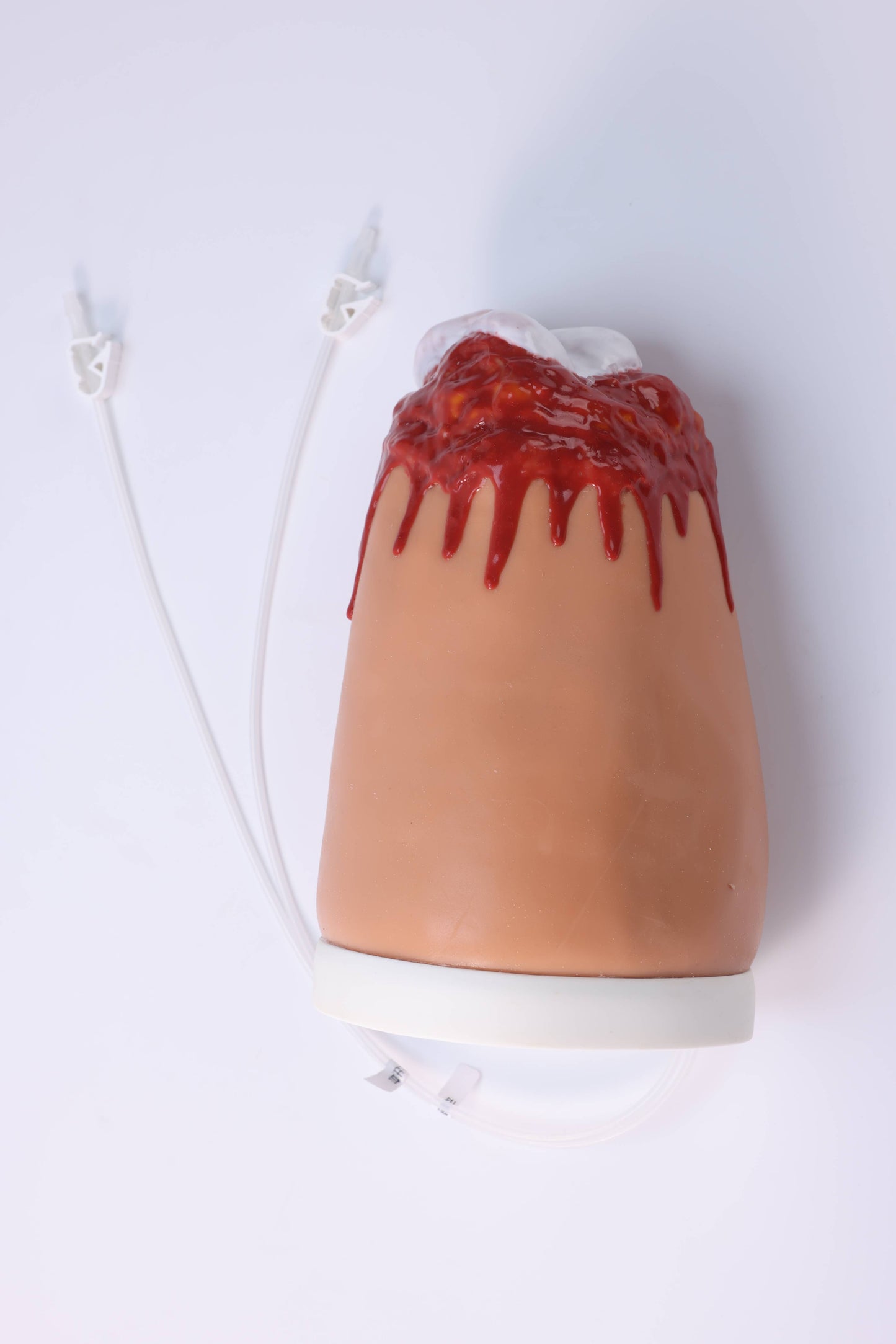 Amputation and Trauma Bleeding Leg