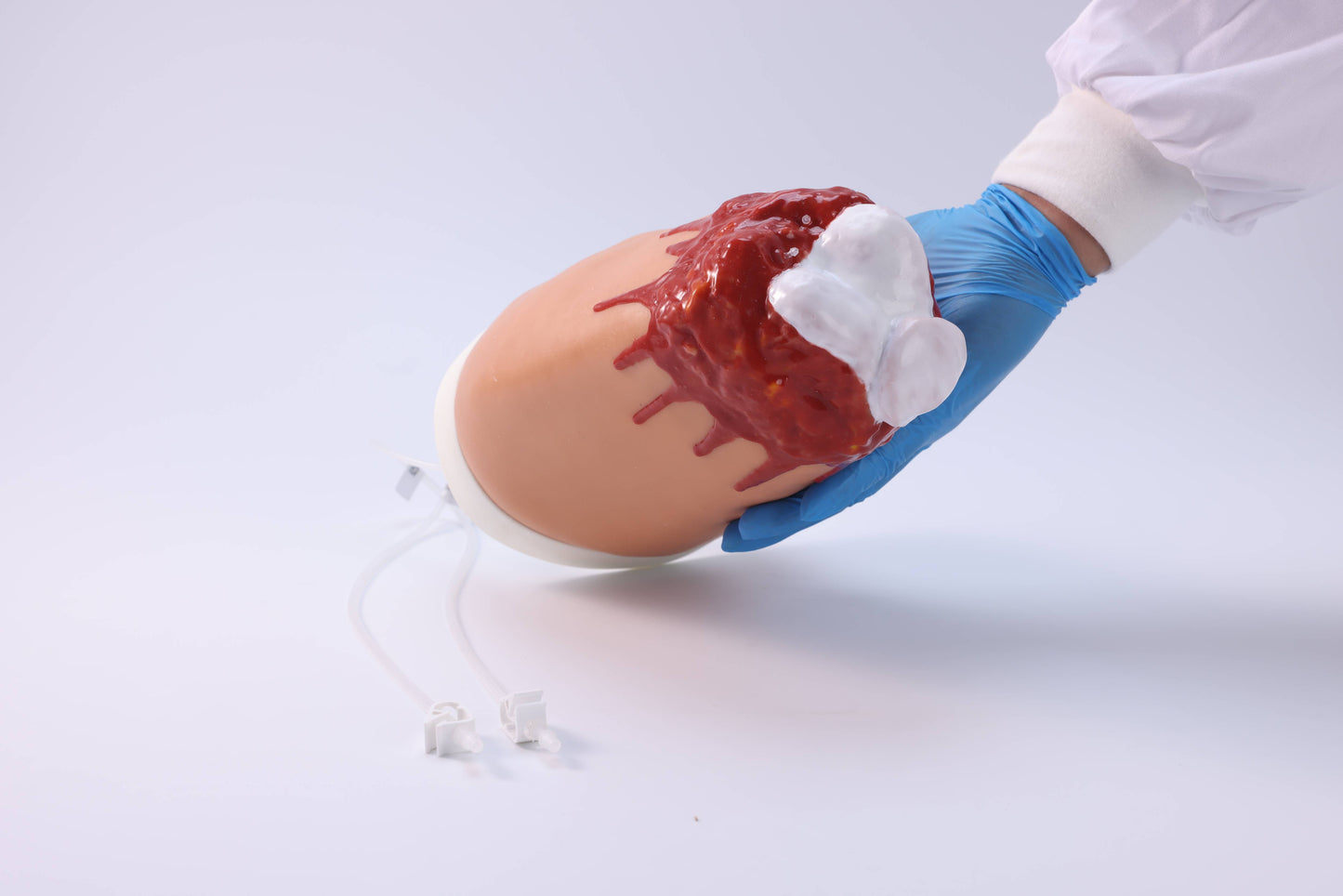 Amputation and Trauma Bleeding Leg