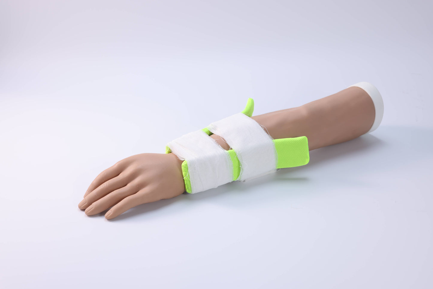 Forearm Fracture  Model