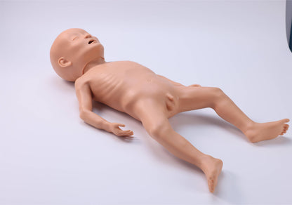 Infant Malnutrition Model
