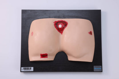 Pressure Ulcer/Bedsore Model