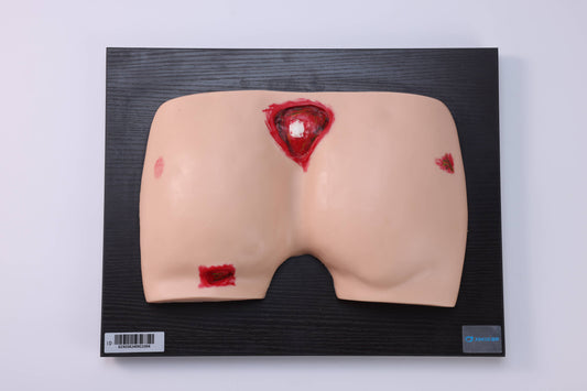Pressure Ulcer/Bedsore Model