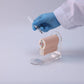 Local Infiltration Anesthesia