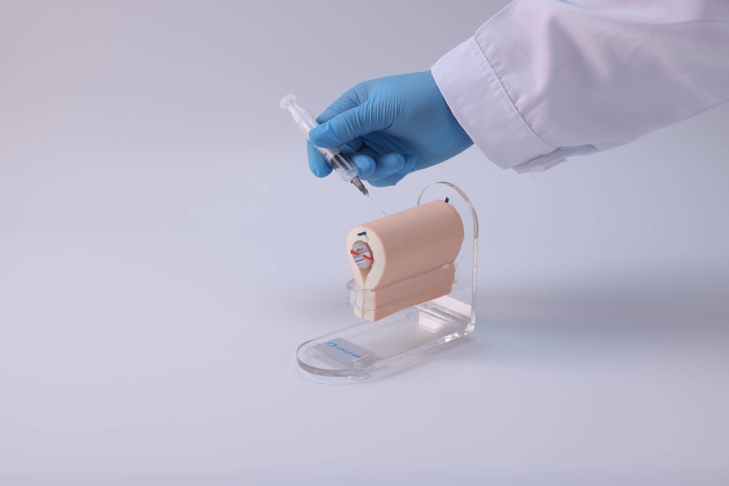 Local Infiltration Anesthesia