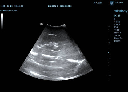 Renal Biopsy Ultrasound Training Model