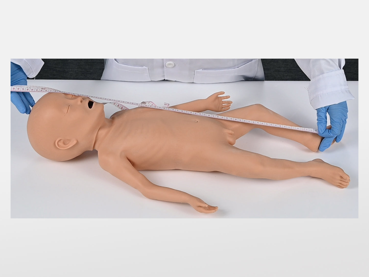 Infant Malnutrition Model