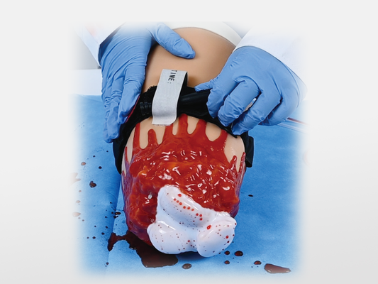 Amputation and Trauma Bleeding Leg